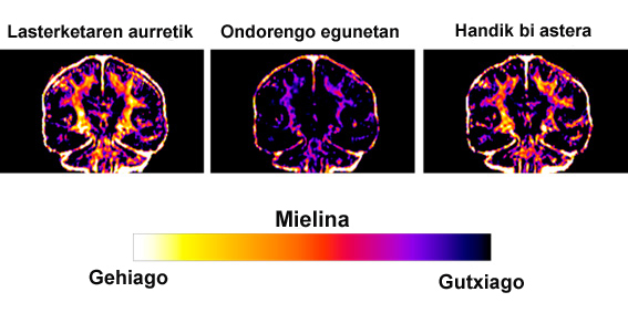 Maratoi baten eragina garunean